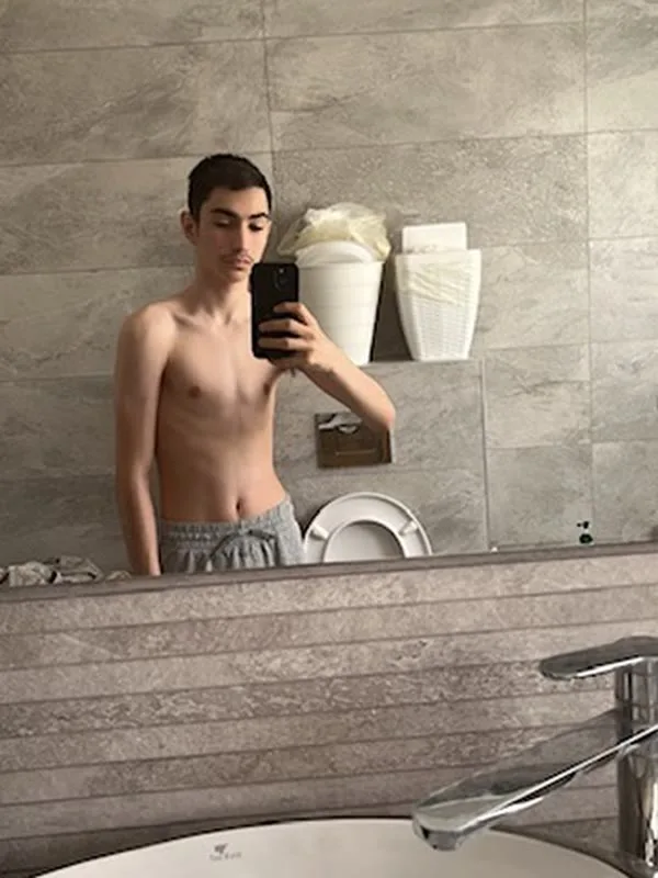 שגיא במשקל 45 ק״ג, לפני תחילת התהליך